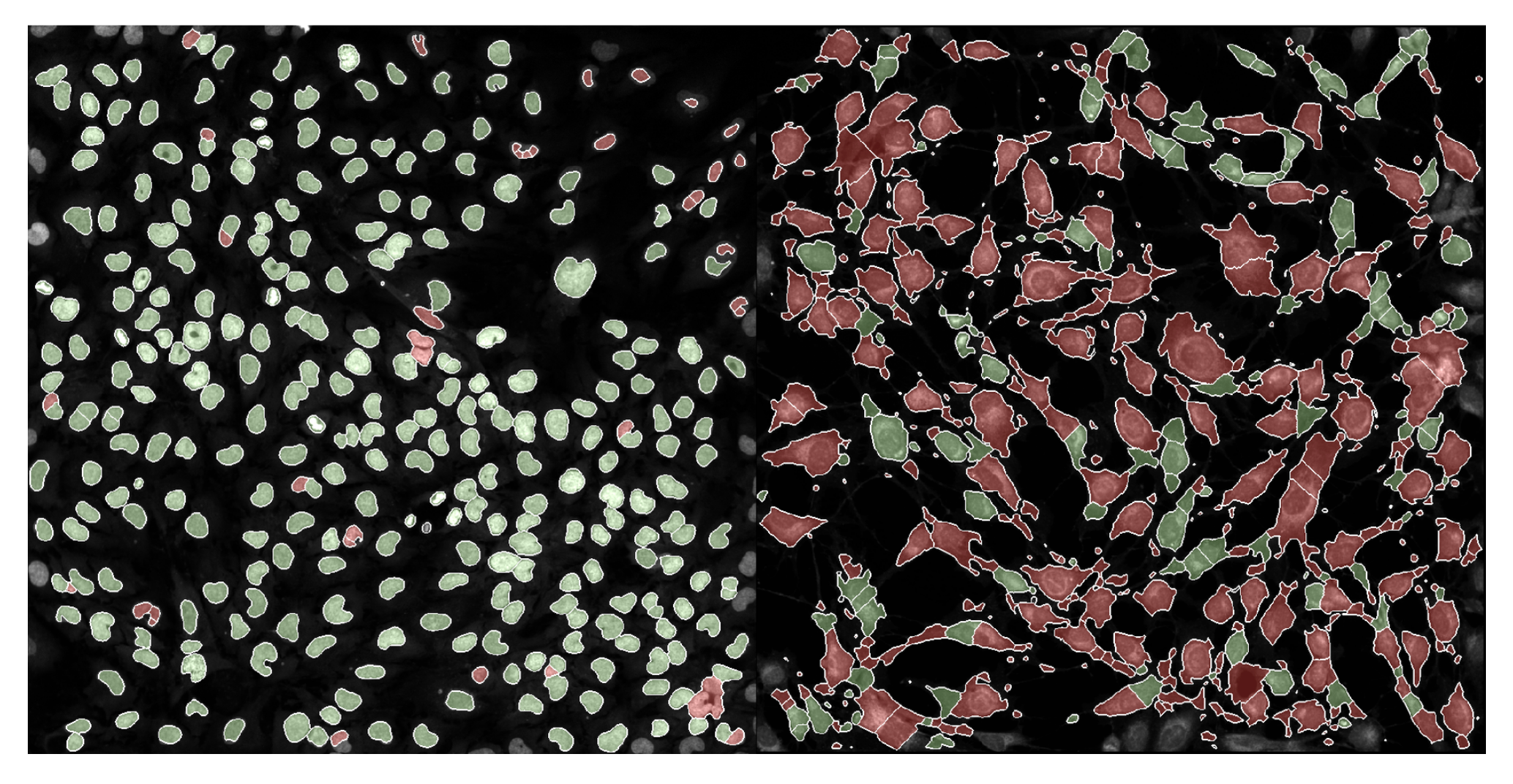 Example of passing (green) and failing (red) single cells for a normal phenotype FOV (left) and interesting phenotype FOV (right). Example of passing (green) and failing (red) single cells for a normal phenotype FOV (left) and interesting phenotype FOV (right).