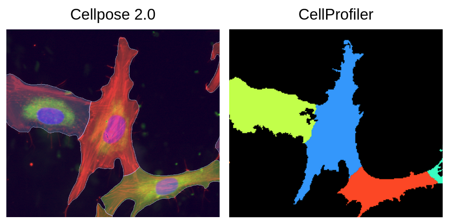 cellprofiler separate cells by shape